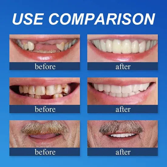 Multiple fuller-looking smile appearance comparisons