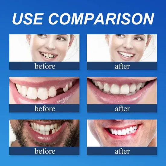 Additional adult smile appearance comparisons