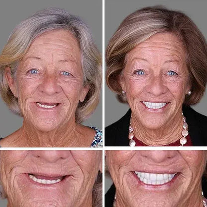 🏆 Ends Today: Save Up to 50% — A 2026 Customer Favorite for a More Comfortable, Confident Smile 🌎