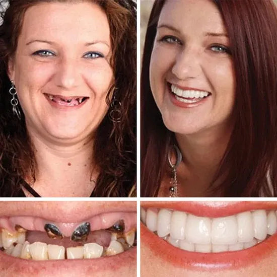 🏆 Ends Today: Save Up to 50% — A 2026 Customer Favorite for a More Comfortable, Confident Smile 🌎
