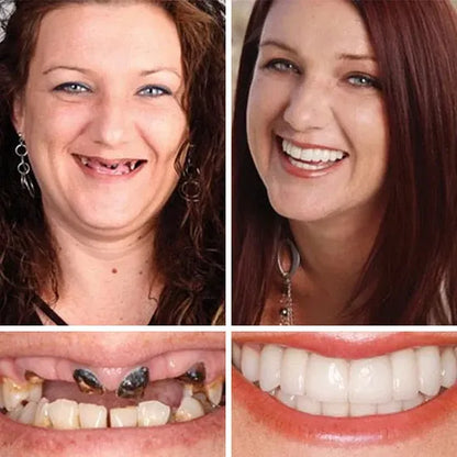 🏆 Ends Today: Save Up to 50% — A 2026 Customer Favorite for a More Comfortable, Confident Smile 🌎